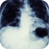 Lung Cancer: Care Considerations